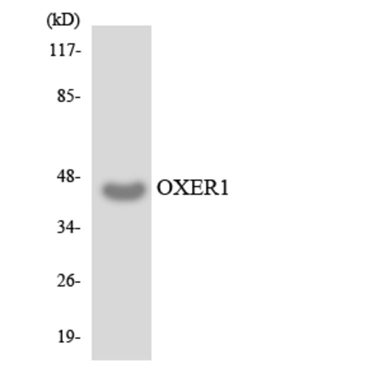 Western Blot - Anti-OXER1 Antibody (R12-3278) - Antibodies.com