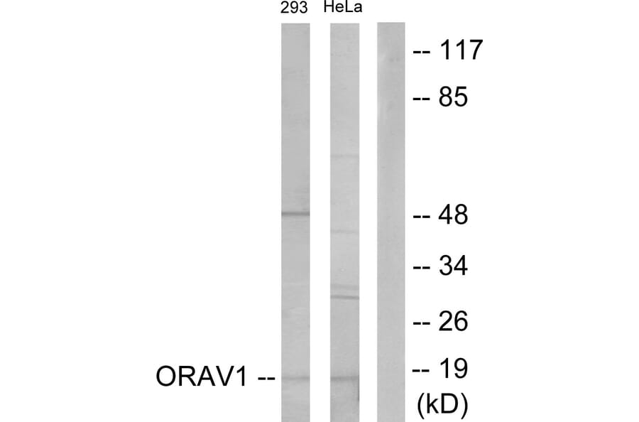 Western Blot - Anti-ORAV1 Antibody (C11406) - Antibodies.com