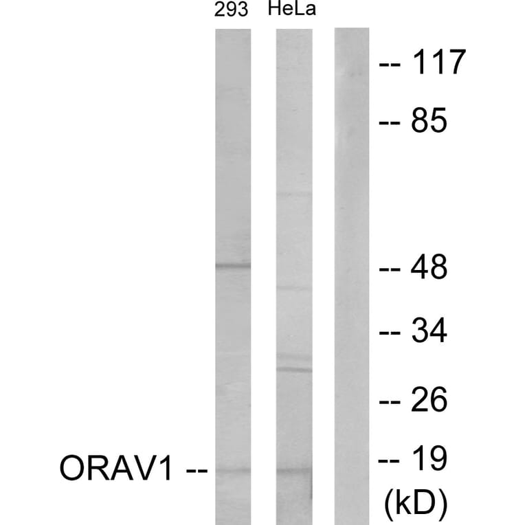 Western Blot - Anti-ORAV1 Antibody (C11406) - Antibodies.com
