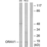 Western Blot - Anti-ORAV1 Antibody (C11406) - Antibodies.com