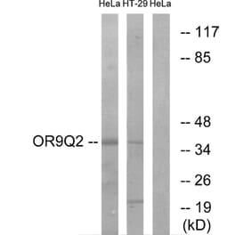 Western Blot - Anti-OR9Q2 Antibody (G702) - Antibodies.com