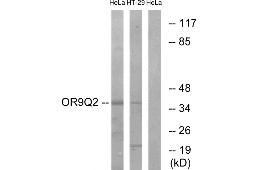 Western Blot - Anti-OR9Q2 Antibody (G702) - Antibodies.com