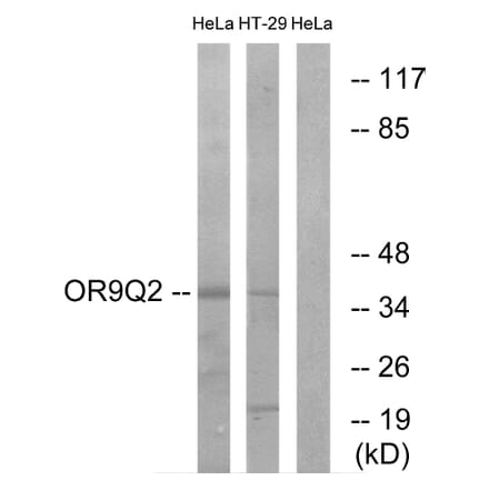 Western Blot - Anti-OR9Q2 Antibody (G702) - Antibodies.com