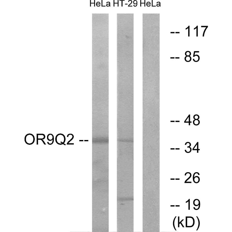 Western Blot - Anti-OR9Q2 Antibody (G702) - Antibodies.com