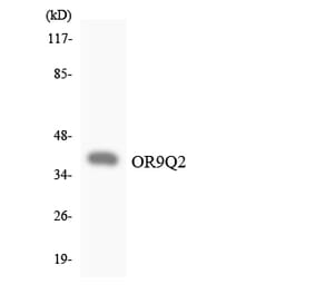Western Blot - Anti-OR9Q2 Antibody (R12-3276) - Antibodies.com
