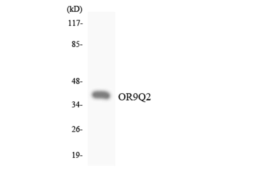 Western Blot - Anti-OR9Q2 Antibody (R12-3276) - Antibodies.com