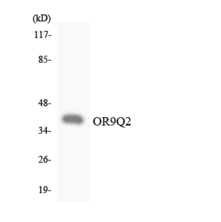 Western Blot - Anti-OR9Q2 Antibody (R12-3276) - Antibodies.com