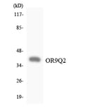Western Blot - Anti-OR9Q2 Antibody (R12-3276) - Antibodies.com