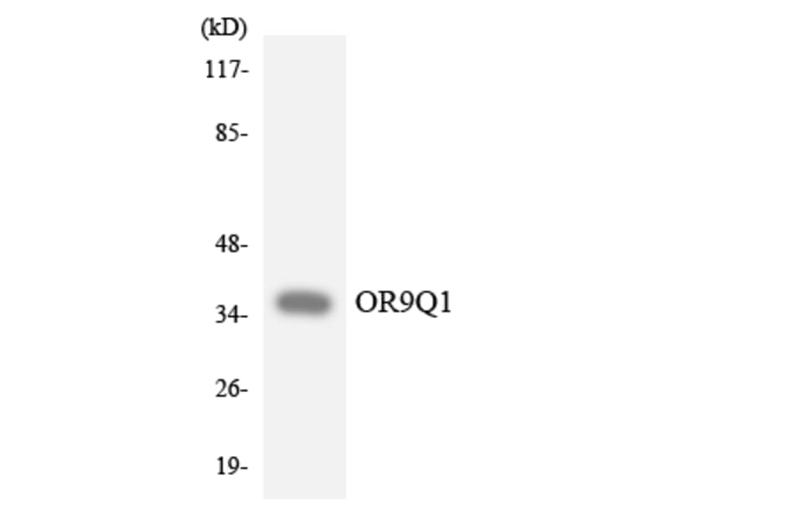 Western Blot - Anti-OR9Q1 Antibody (R12-3275) - Antibodies.com