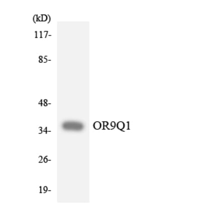 Western Blot - Anti-OR9Q1 Antibody (R12-3275) - Antibodies.com
