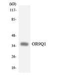 Western Blot - Anti-OR9Q1 Antibody (R12-3275) - Antibodies.com
