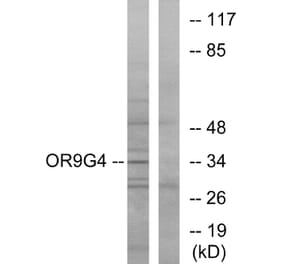 Western Blot - Anti-OR9G4 Antibody (G698) - Antibodies.com