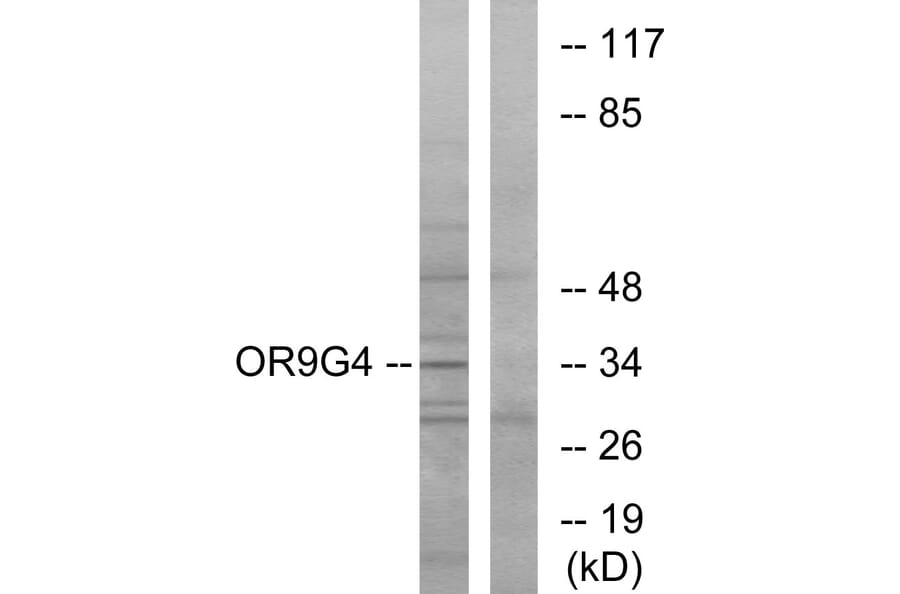Western Blot - Anti-OR9G4 Antibody (G698) - Antibodies.com