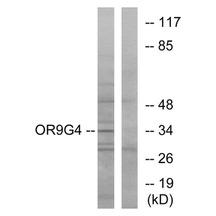Western Blot - Anti-OR9G4 Antibody (G698) - Antibodies.com
