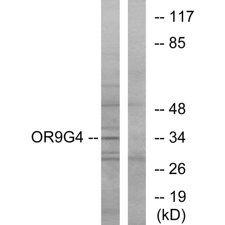 Western Blot - Anti-OR9G4 Antibody (G698) - Antibodies.com