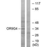 Western Blot - Anti-OR9G4 Antibody (G698) - Antibodies.com