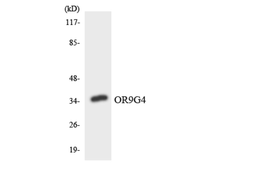 Western Blot - Anti-OR9G4 Antibody (R12-3274) - Antibodies.com