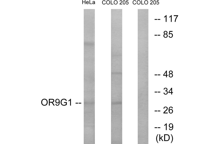 Western Blot - Anti-OR9G1 Antibody (G697) - Antibodies.com