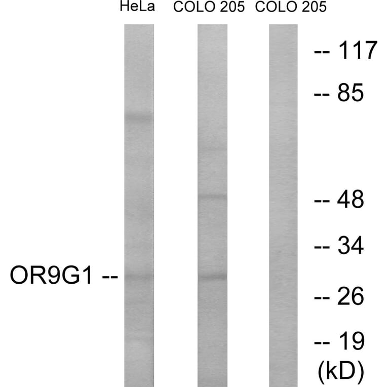 Western Blot - Anti-OR9G1 Antibody (G697) - Antibodies.com