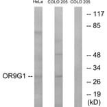 Western Blot - Anti-OR9G1 Antibody (G697) - Antibodies.com