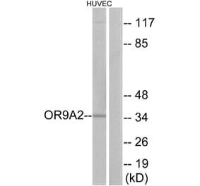 Western Blot - Anti-OR9A2 Antibody (G696) - Antibodies.com