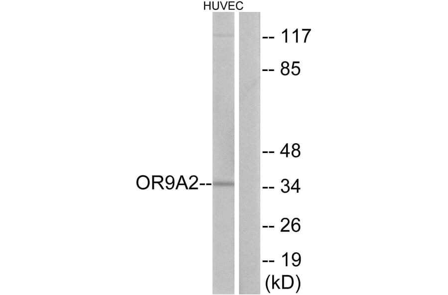 Western Blot - Anti-OR9A2 Antibody (G696) - Antibodies.com