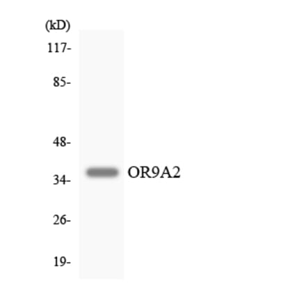 Western Blot - Anti-OR9A2 Antibody (R12-3272) - Antibodies.com