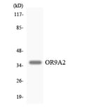 Western Blot - Anti-OR9A2 Antibody (R12-3272) - Antibodies.com