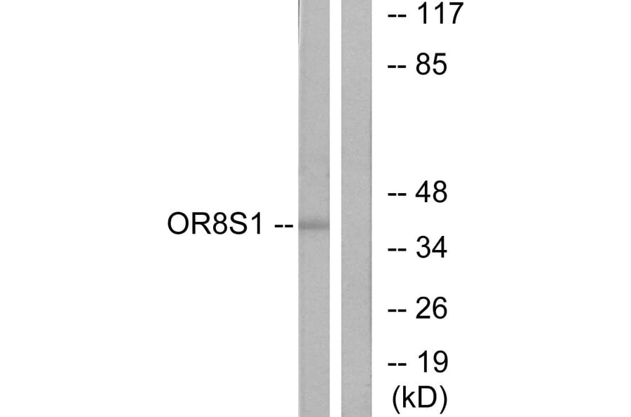 Western Blot - Anti-OR8S1 Antibody (G694) - Antibodies.com