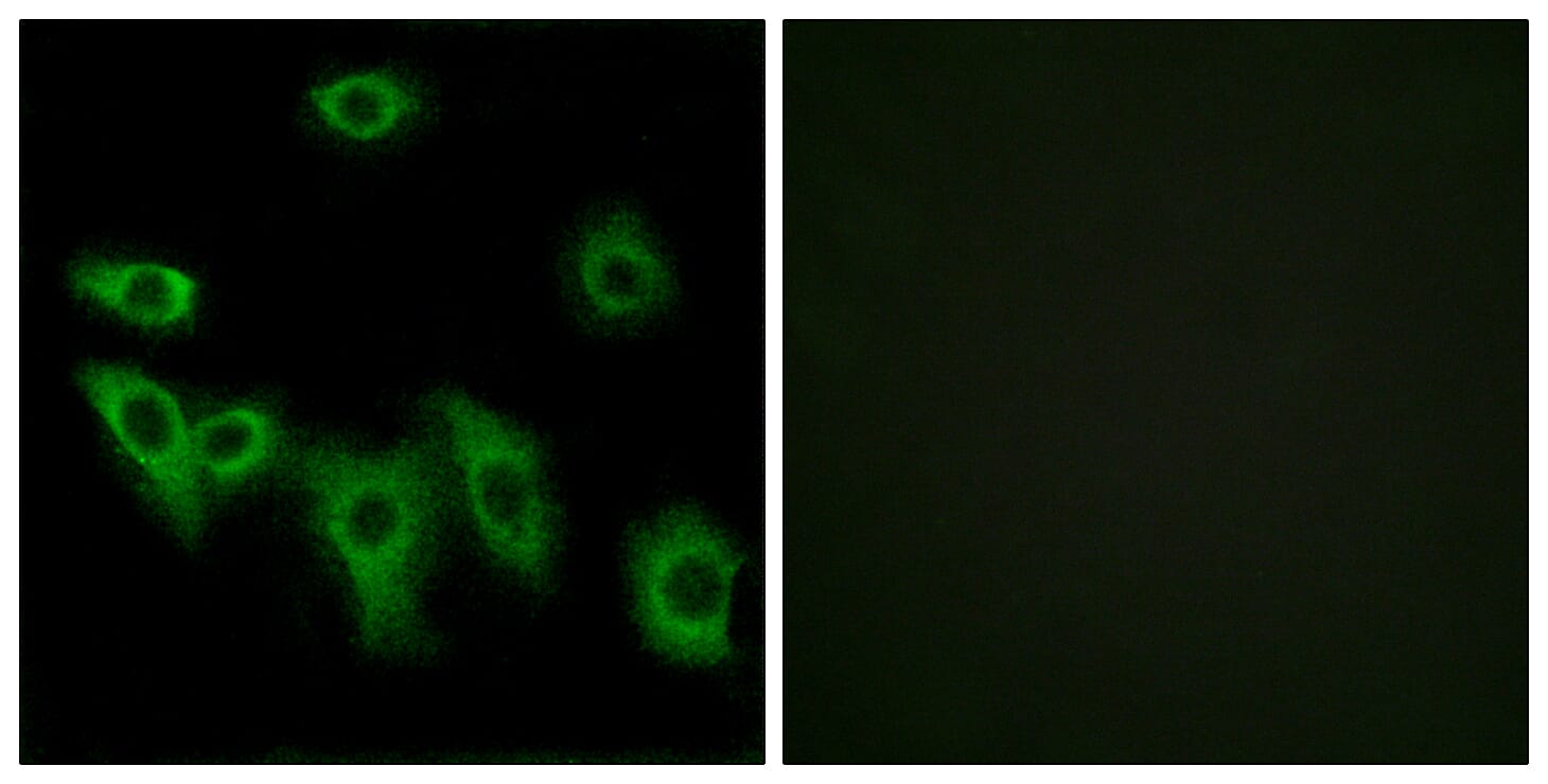 Immunofluorescence analysis of HUVEC cells using Anti-OR8H3 Antibody. The right hand panel represents a negative control, where the antibody was pre-incubated with the immunising peptide.