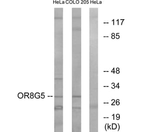 Western Blot - Anti-OR8G5 Antibody (G687) - Antibodies.com