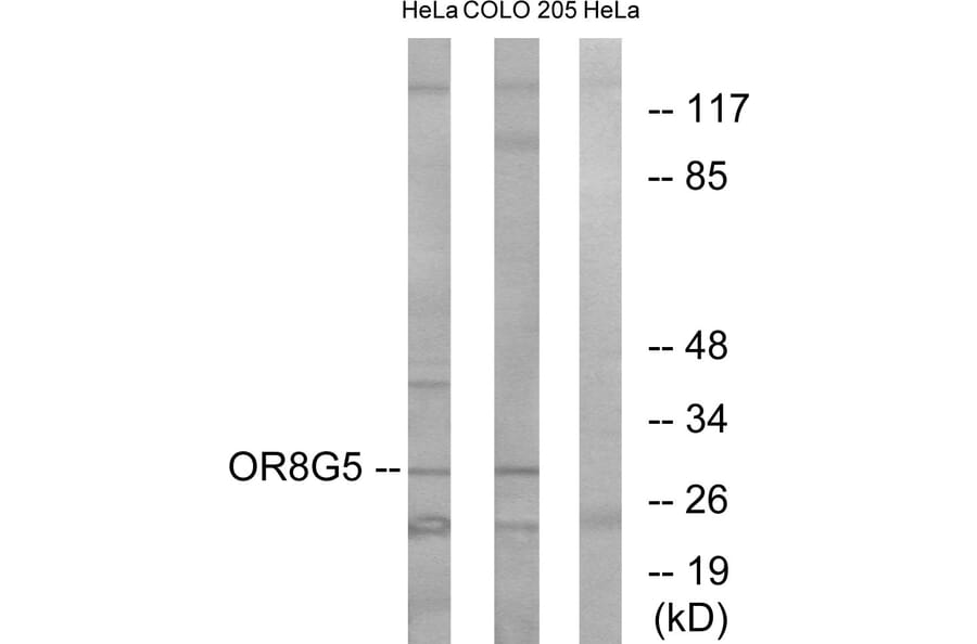 Western Blot - Anti-OR8G5 Antibody (G687) - Antibodies.com