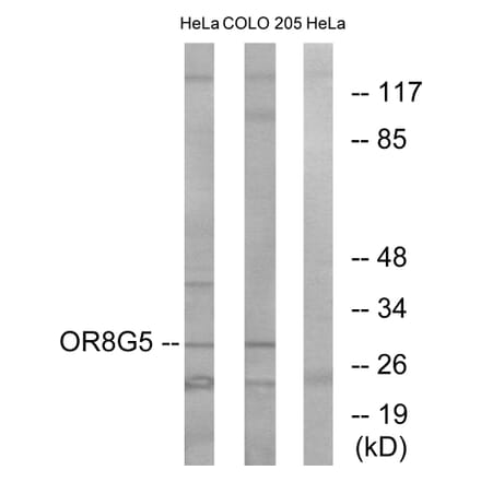 Western Blot - Anti-OR8G5 Antibody (G687) - Antibodies.com