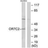 Western Blot - Anti-OR7C2 Antibody (G677) - Antibodies.com