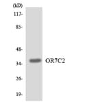 Western Blot - Anti-OR7C2 Antibody (R12-3260) - Antibodies.com