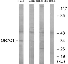 Western Blot - Anti-OR7C1 Antibody (G676) - Antibodies.com