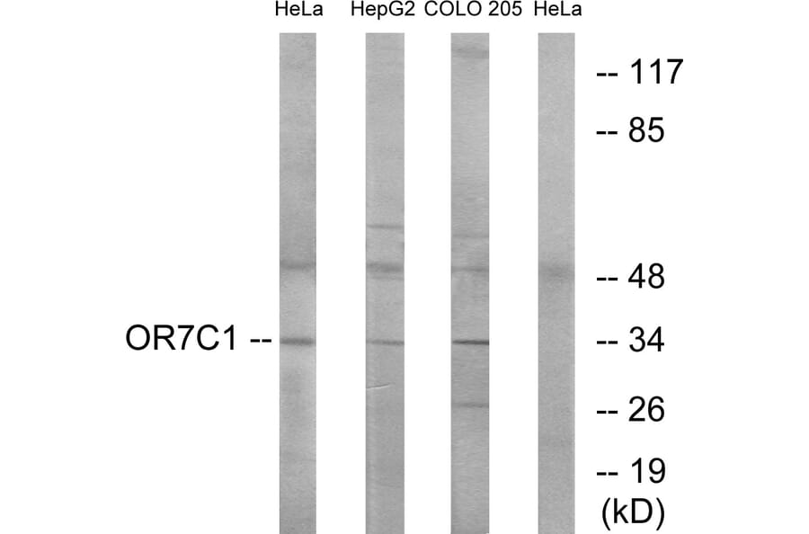 Western Blot - Anti-OR7C1 Antibody (G676) - Antibodies.com