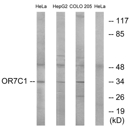 Western Blot - Anti-OR7C1 Antibody (G676) - Antibodies.com