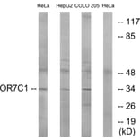 Western Blot - Anti-OR7C1 Antibody (G676) - Antibodies.com