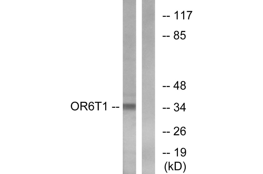 Western Blot - Anti-OR6T1 Antibody (G671) - Antibodies.com