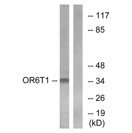 Western Blot - Anti-OR6T1 Antibody (G671) - Antibodies.com