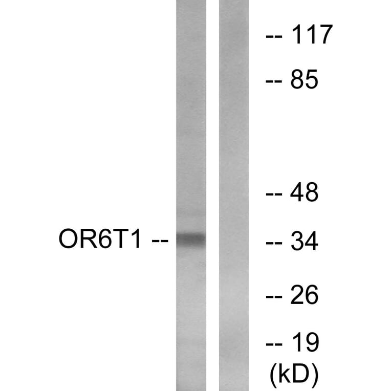 Western Blot - Anti-OR6T1 Antibody (G671) - Antibodies.com