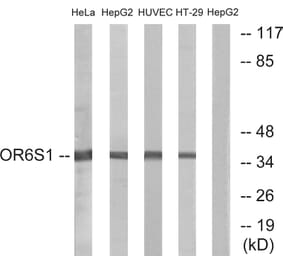 Western Blot - Anti-OR6S1 Antibody (G670) - Antibodies.com