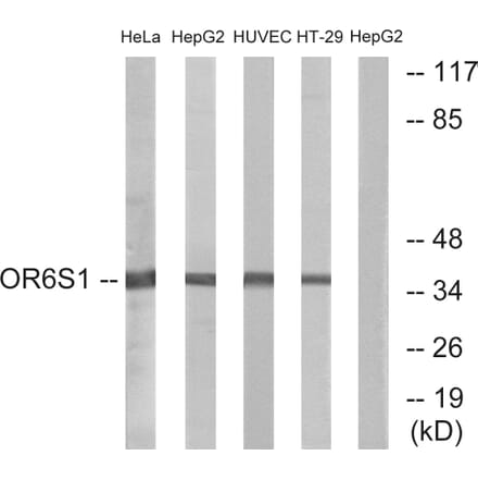 Western Blot - Anti-OR6S1 Antibody (G670) - Antibodies.com