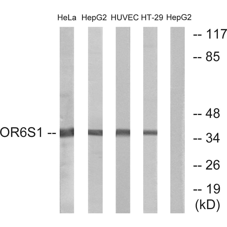 Western Blot - Anti-OR6S1 Antibody (G670) - Antibodies.com