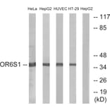 Western Blot - Anti-OR6S1 Antibody (G670) - Antibodies.com