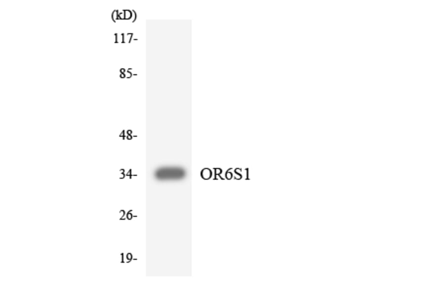 Western Blot - Anti-OR6S1 Antibody (R12-3256) - Antibodies.com