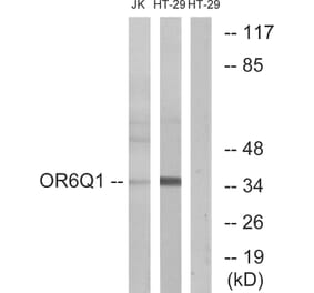 Western Blot - Anti-OR6Q1 Antibody (G669) - Antibodies.com