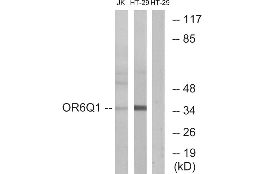Western Blot - Anti-OR6Q1 Antibody (G669) - Antibodies.com