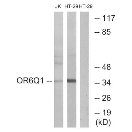 Western Blot - Anti-OR6Q1 Antibody (G669) - Antibodies.com